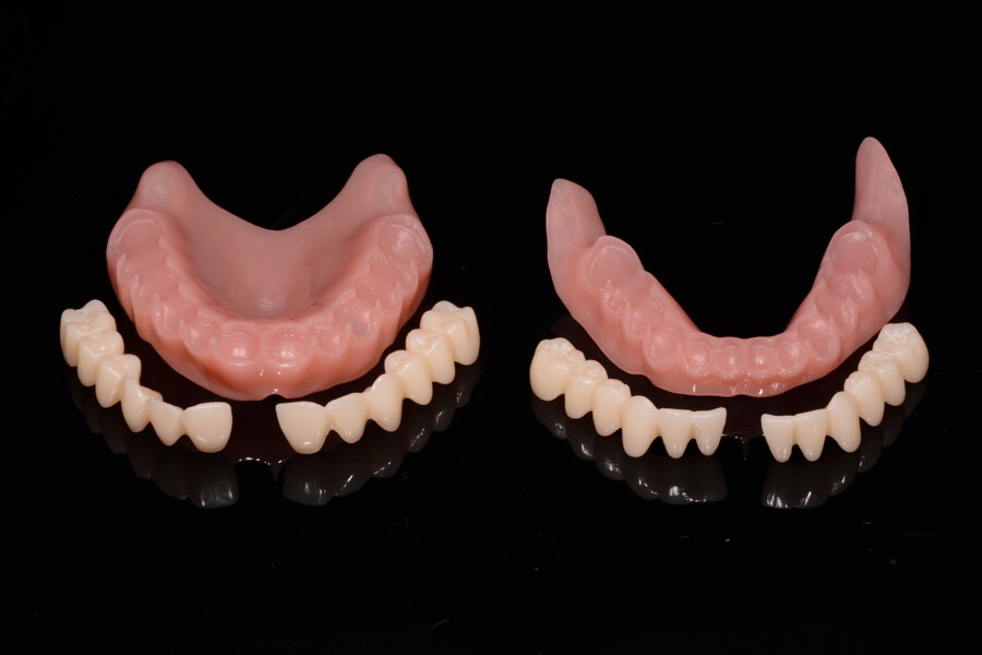 Fig. 20: Polished denture bases and tooth segments before luting.