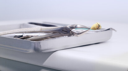 Dental practices urged to install amalgam separator