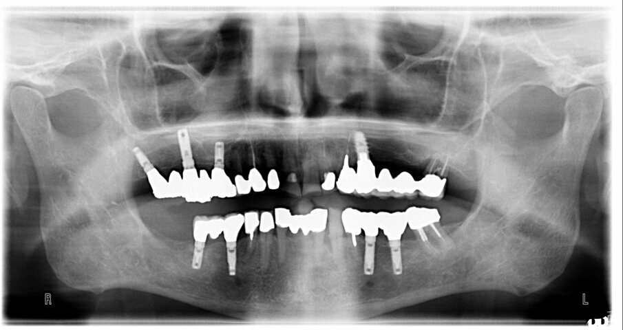 Fig. 5a
