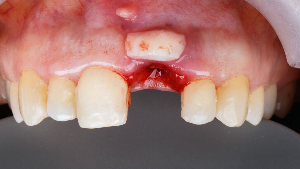 “We can look forward to decisive progress in soft-tissue regeneration in the coming years”