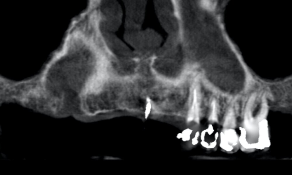 Fig. 9