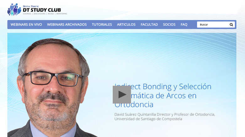 Indirect bonding y selección automática de arcos en ortodoncia
