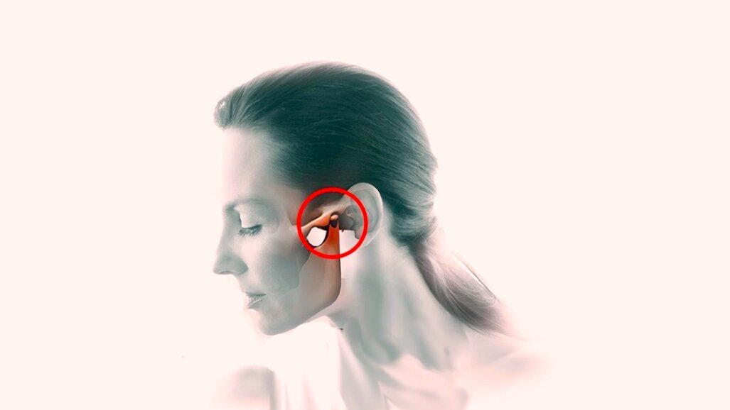 Curso de disfunción craneomandibular y dolor orofacial