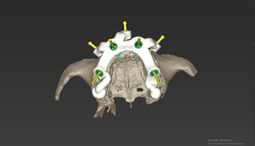 Fig. 12