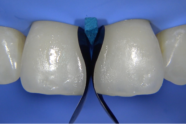 Case 2, Fig. 2.