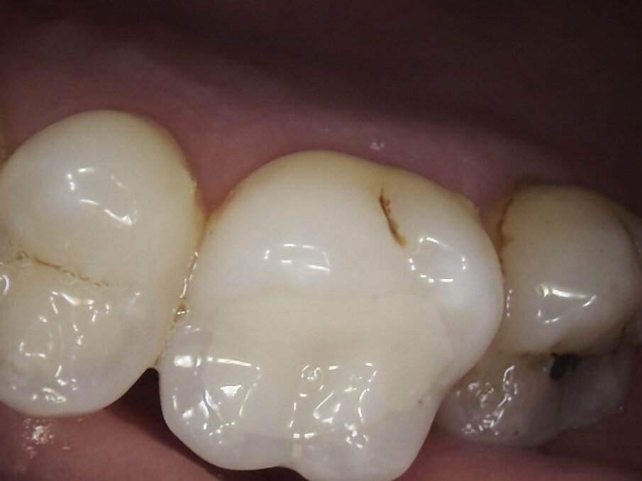 Fig. 11: End result