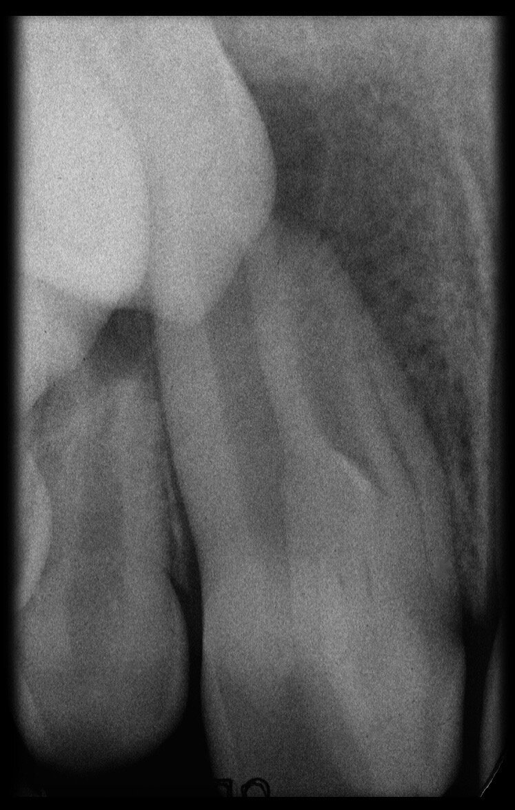 Fig. 32