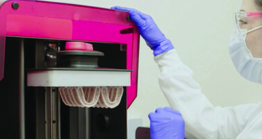 SprintRay expands in-office orthodontic 3-D printing offerings
