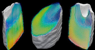 Una nueva técnica visualiza las nanoestructuras de los dientes