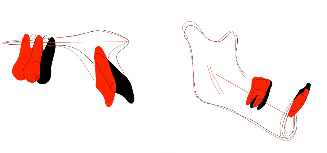 Fig. 9b