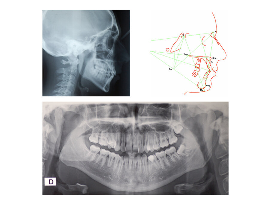 Fig. 2