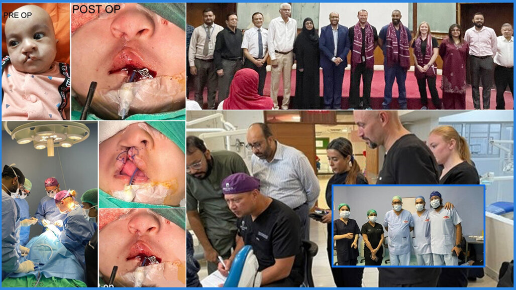 First welfare cleft mission by JMDC