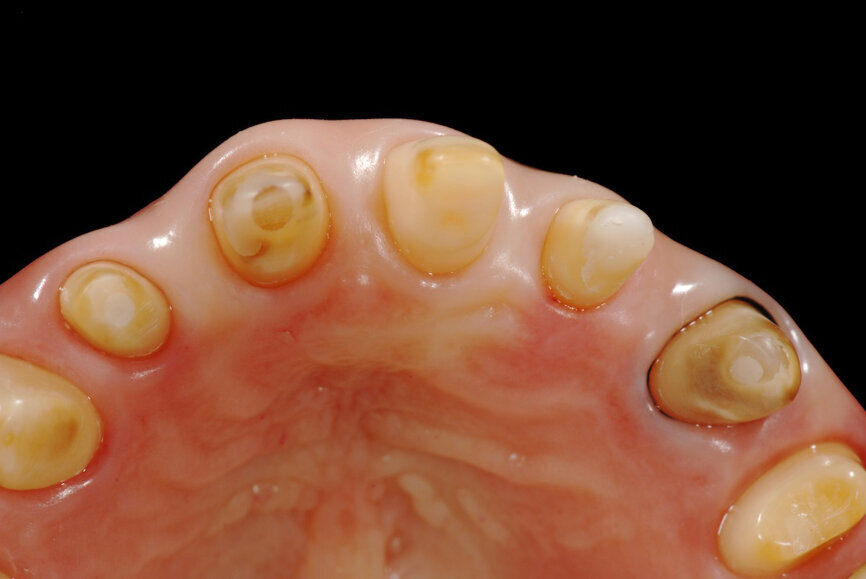 Fig. 7