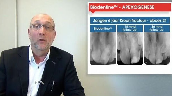 Ontdek in een korte weblezing de mogelijkheden van Biodentine