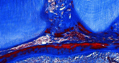 King’s proves method to help teeth repair themselves