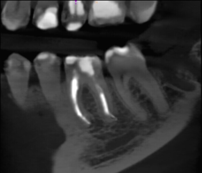 Fig. 39b