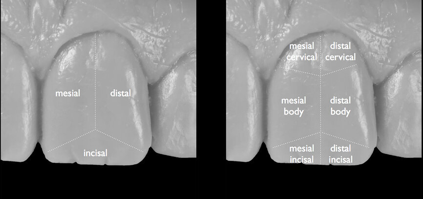 Fig. 18: Segmentation of the tooth and full segments divided into half segments.