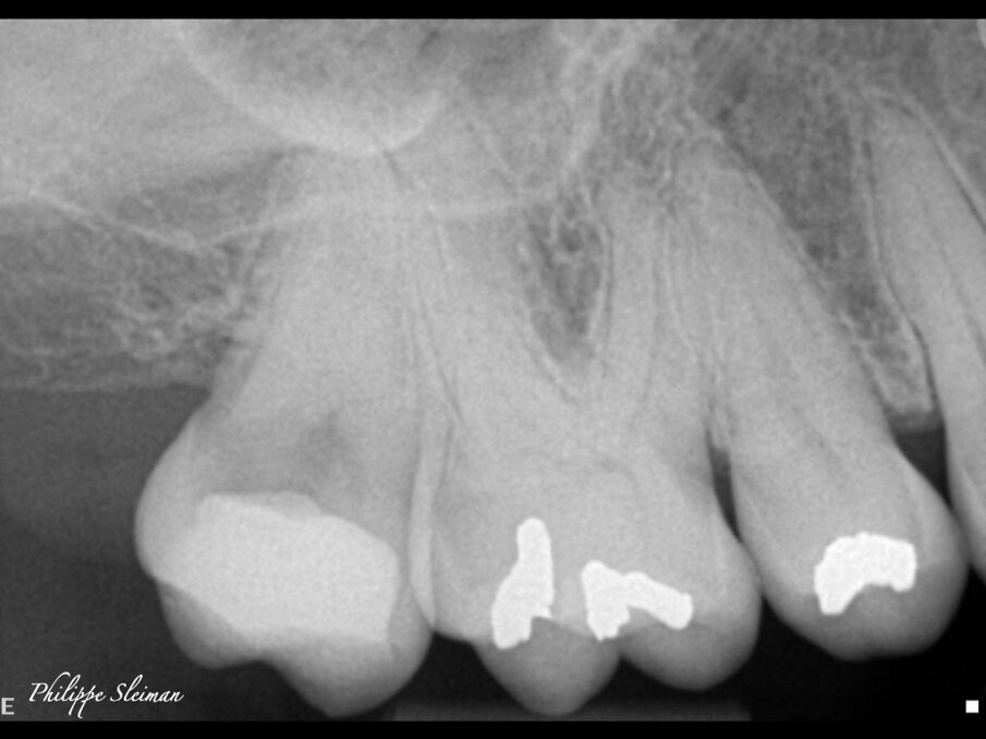 Fig. 12