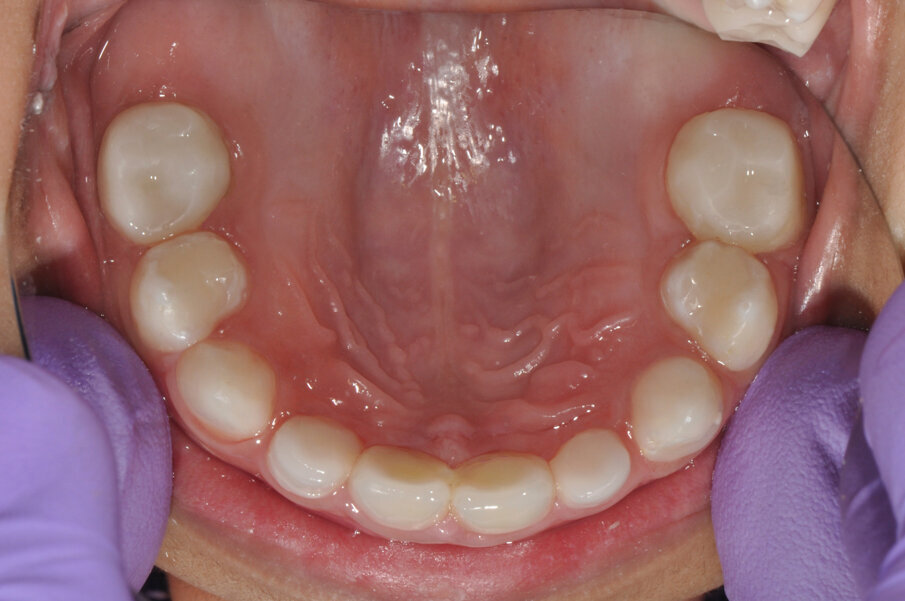 Fig. 12: Postoperative situation.