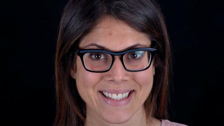 « L’ engagement psychologique» en dentisterie esthétique