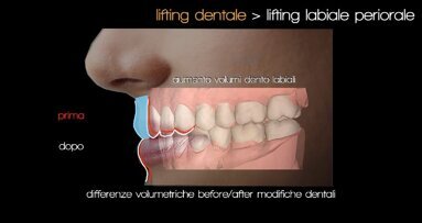 Logopedia Estetica Funzionale: quali sinergie con l’odontoiatria e la medicina estetica?