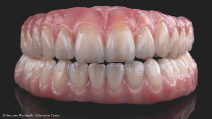 Zirconia hecha con orgullo