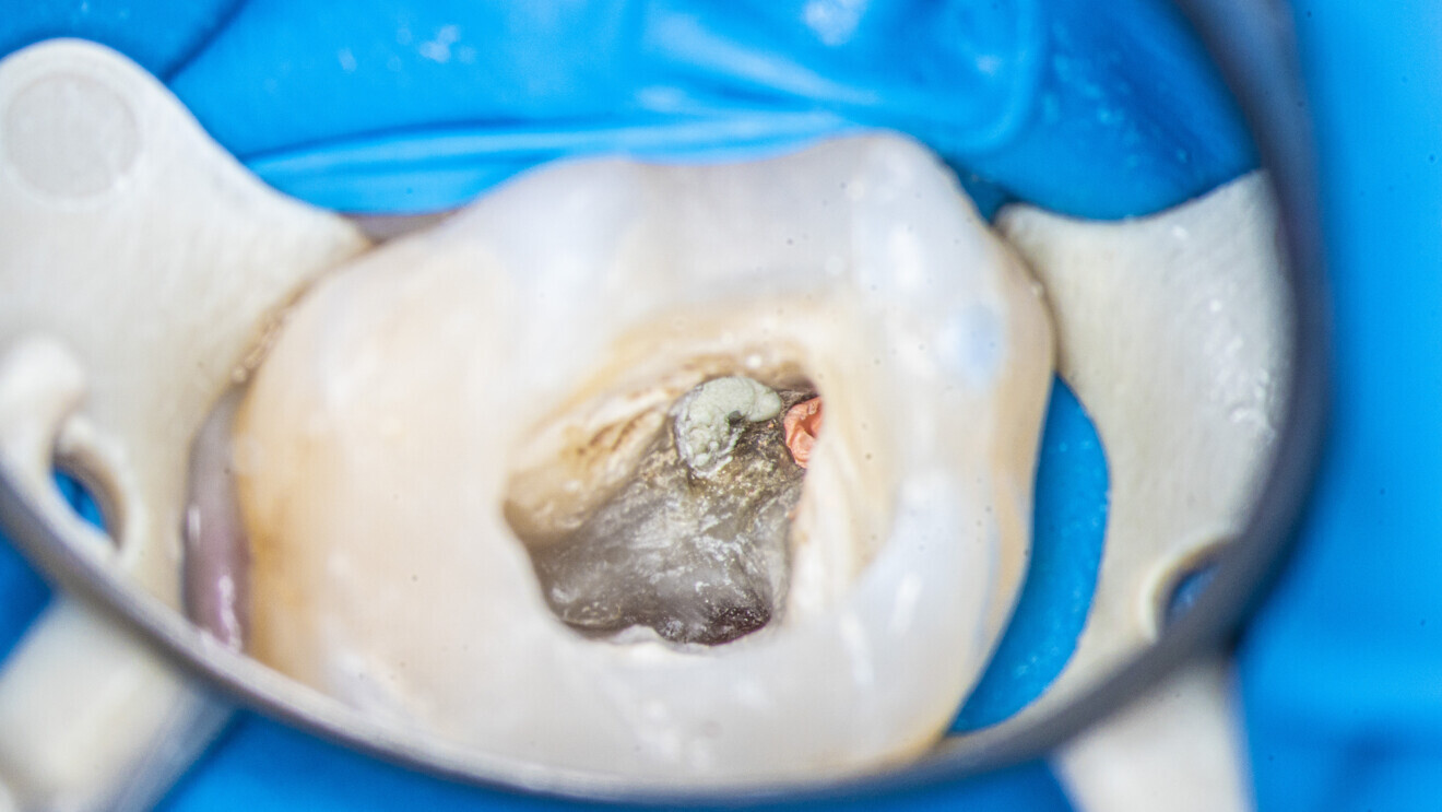 Fig. 10