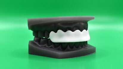 Nueva férula de reposicionamiento mandibular