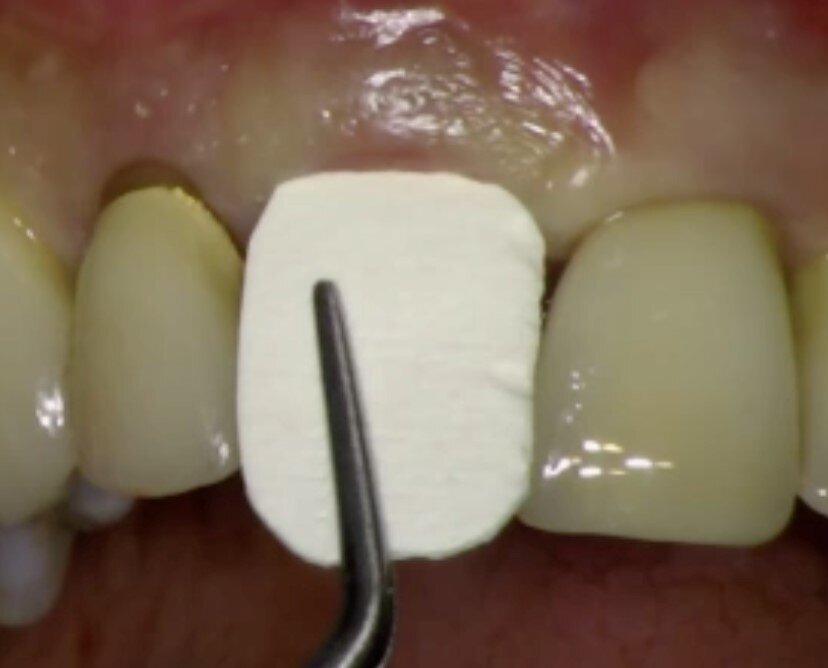 Fig. 11
