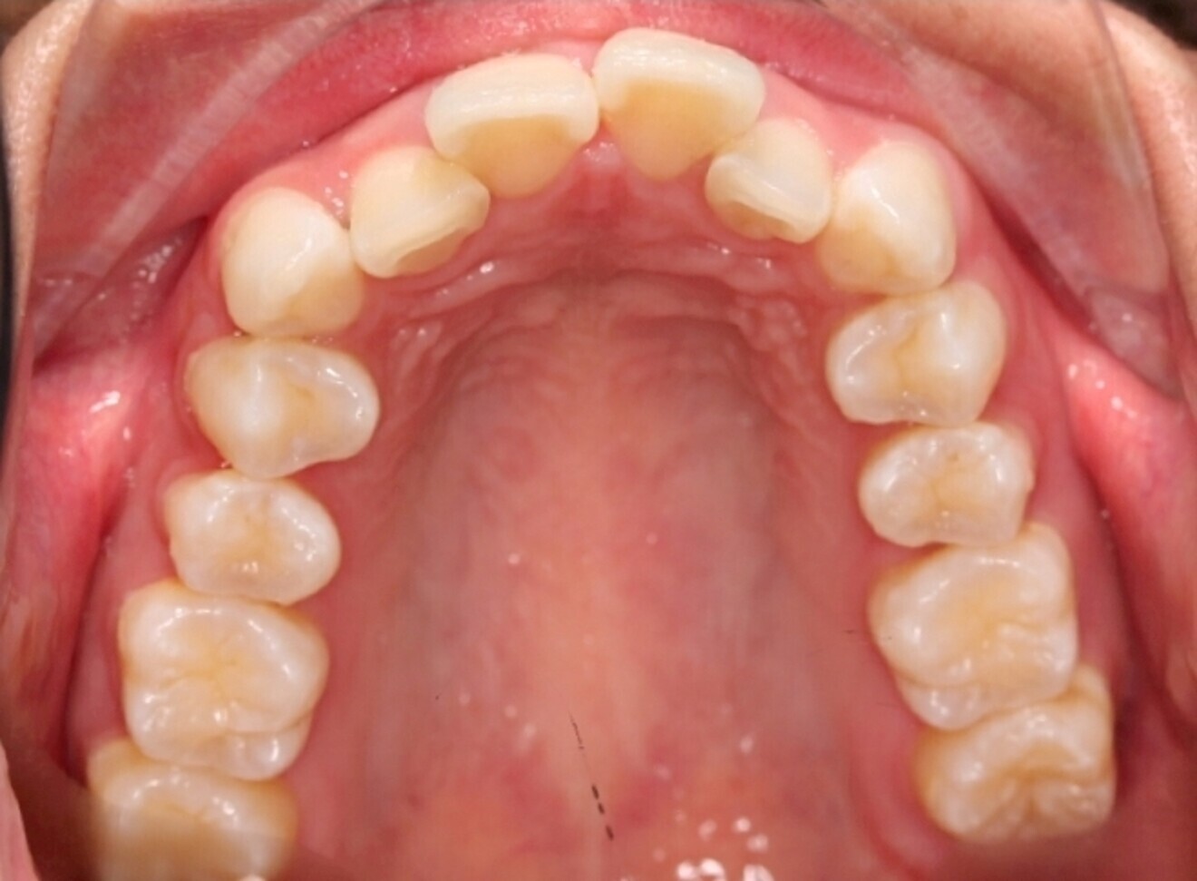 Fig. 6