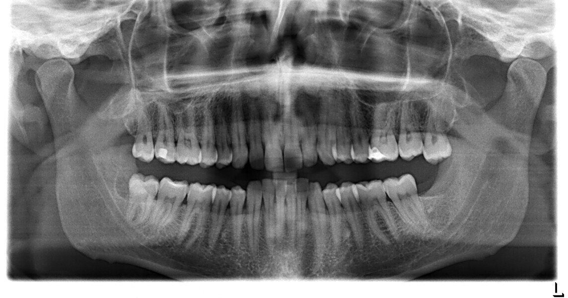 Fig. 18