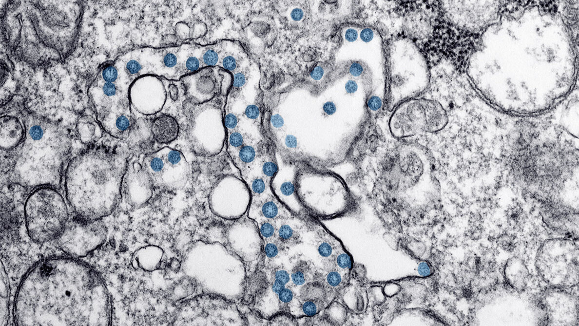 Henry Schein announces further efforts to address the COVID-19 pandemic