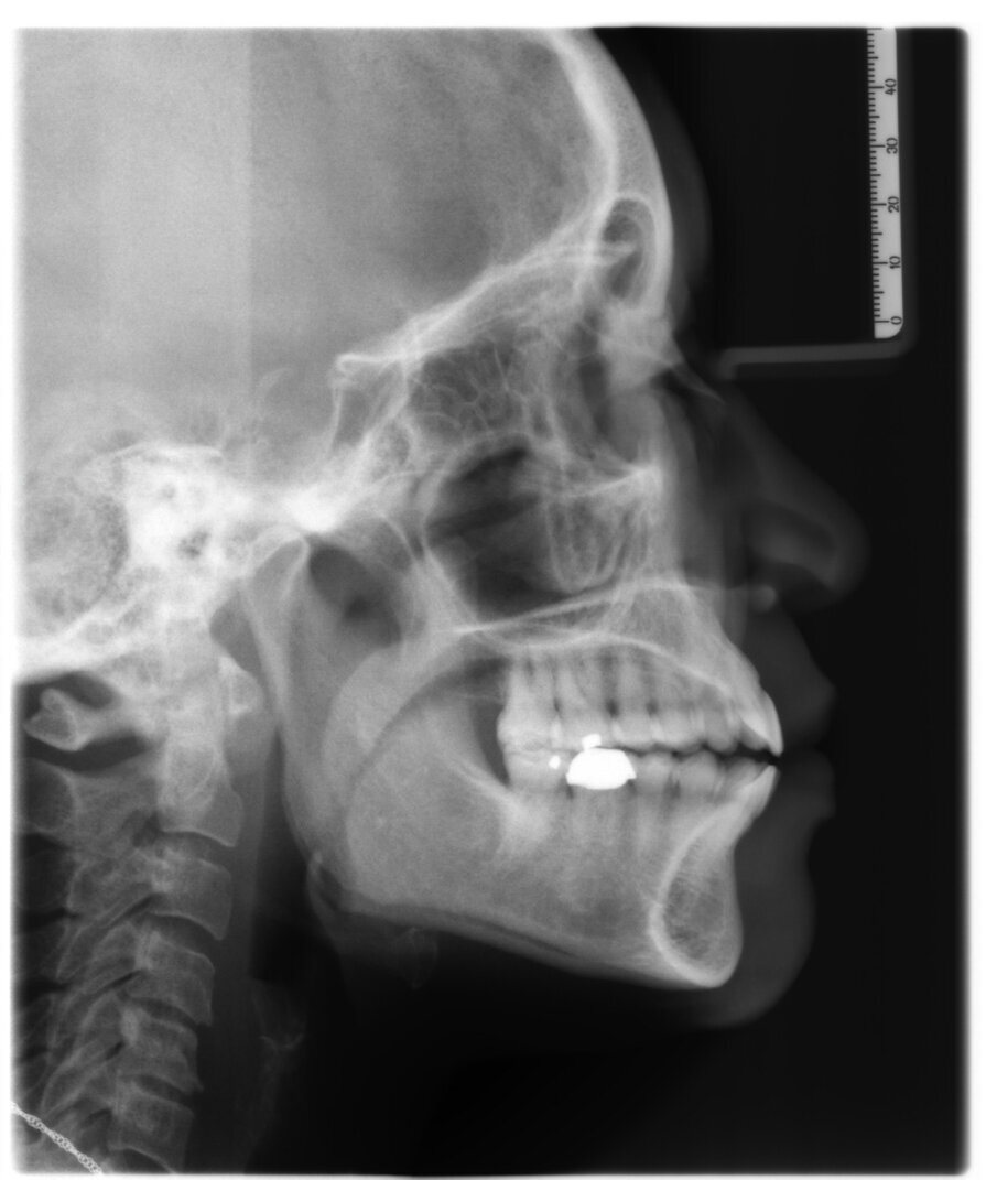 Fig. 9