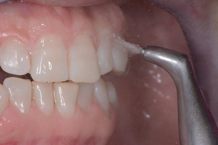 Fig. 8a