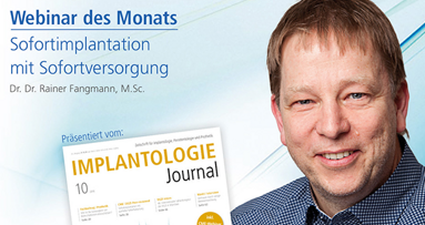Webinar: Sofortimplantation mit Sofortversorgung