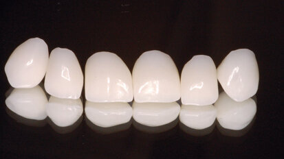 Co CAD/CAM zmienia w gabinecie