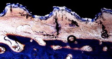 !!!EAO Periodontally integrated implants: Reality or fiction?