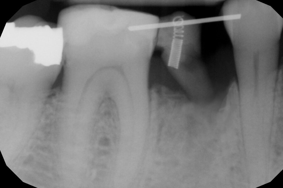 Fig. 11
