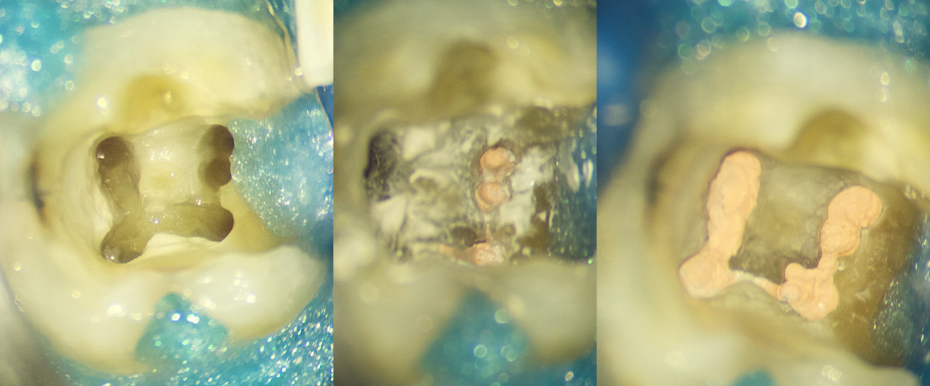 Fig. 11