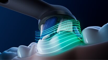 Periodontal disease carries a measurable environmental cost