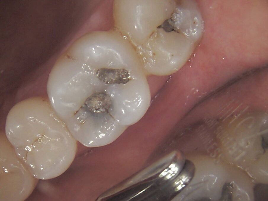 FONA Dental ME (4)
