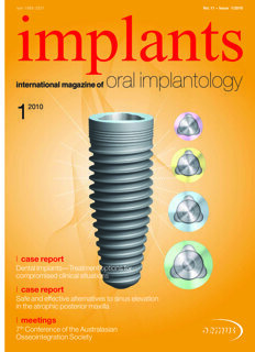 implants international