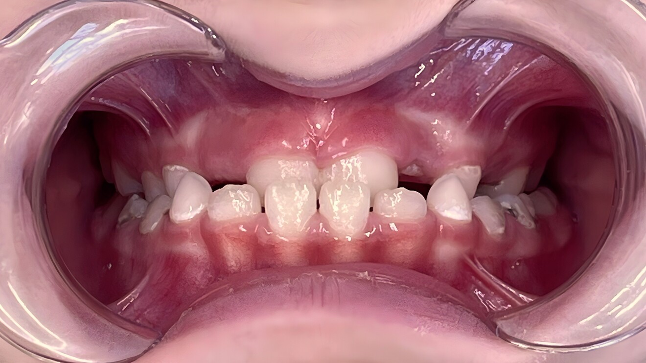 Fig. 1e