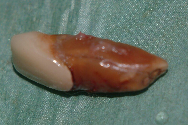 Fig. 4