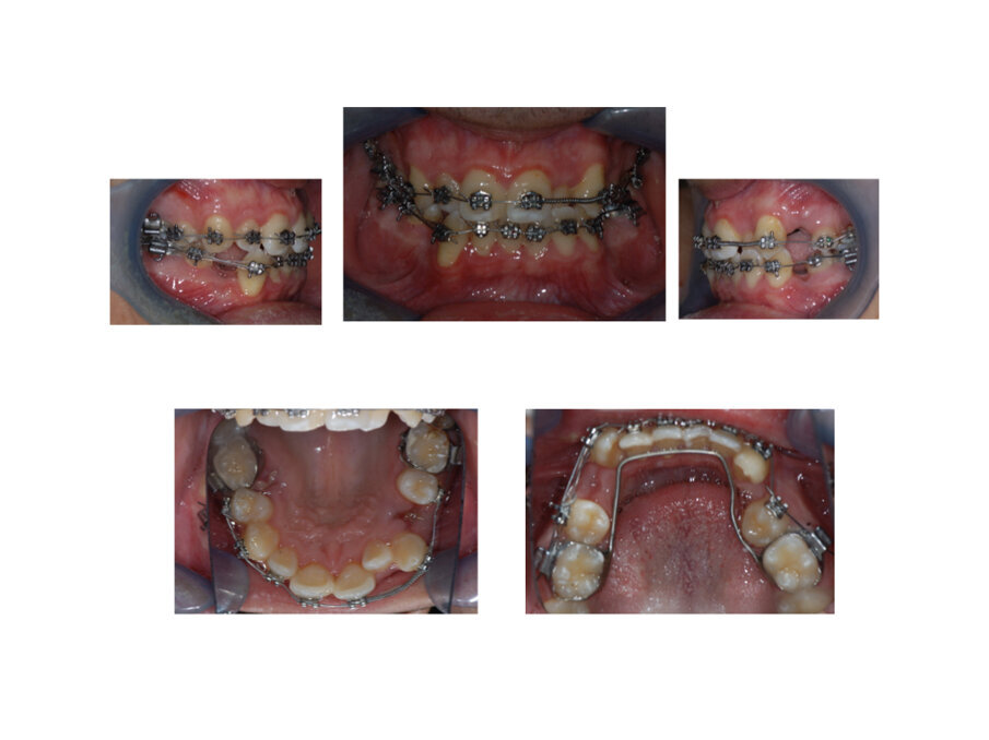 Fig. 3