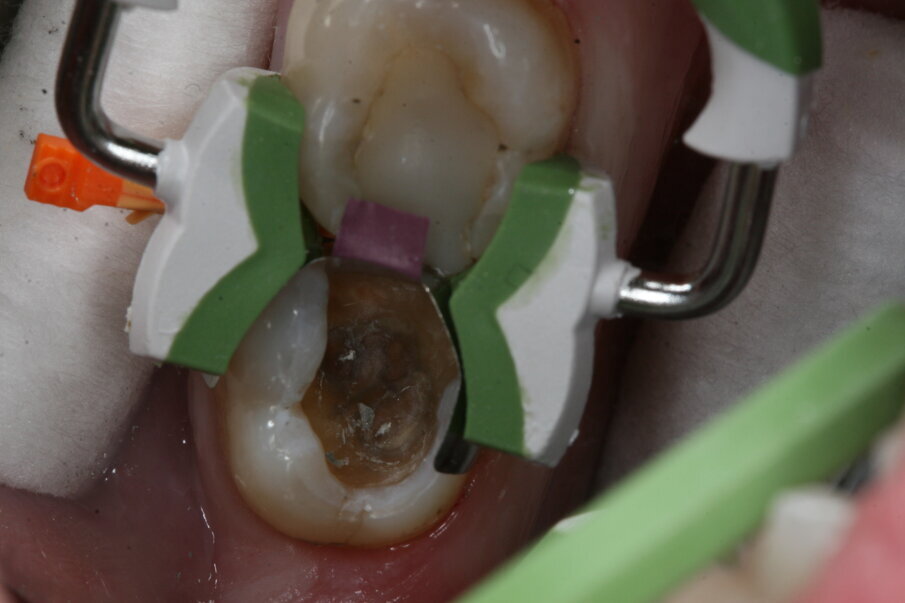 Fig. 8