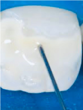 Fig. 11