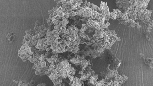 Tooth fillings of the future may incorporate bioactive glass