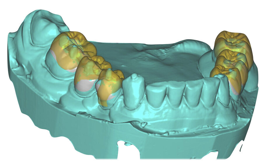 Fig. 29
