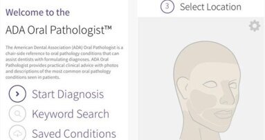 App helpt tandarts bij diagnose orale pathologie